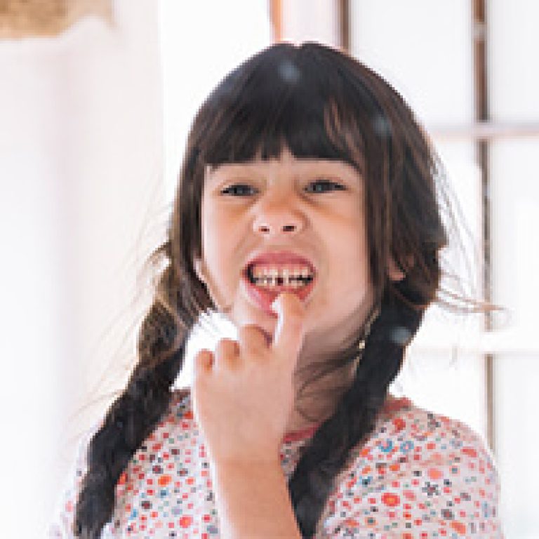 ayrik-on-dislerin-arasi-nasil-kapanir