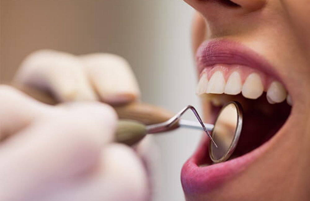 periodontoloji-tedavisi-avantajlari periodontoloji-tedavisi-avantajlari