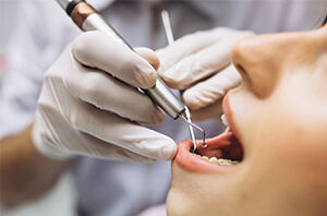 10-maddede-dental-implantin-avantajlari-1