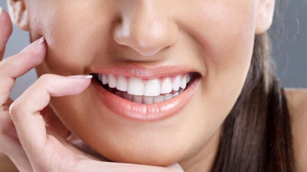 Diş beyazlatma sonrası sararma, sızlama, ağrı, diş beyazlatma sonrası dikkat edilmesi gerekenler