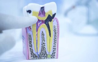 Dolgulu diş neden ağrır? Dolgulu diş ağrısı, dolgulu diş ağrısına ne iyi gelir?