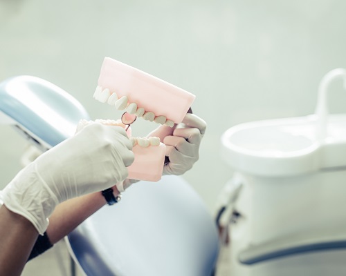 Endodontik Tedavinin Aşamaları Nelerdir?