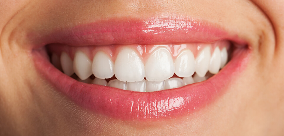 nisantasi periodontoloji tedavisi, periodontoloji tedavisi nisantasi